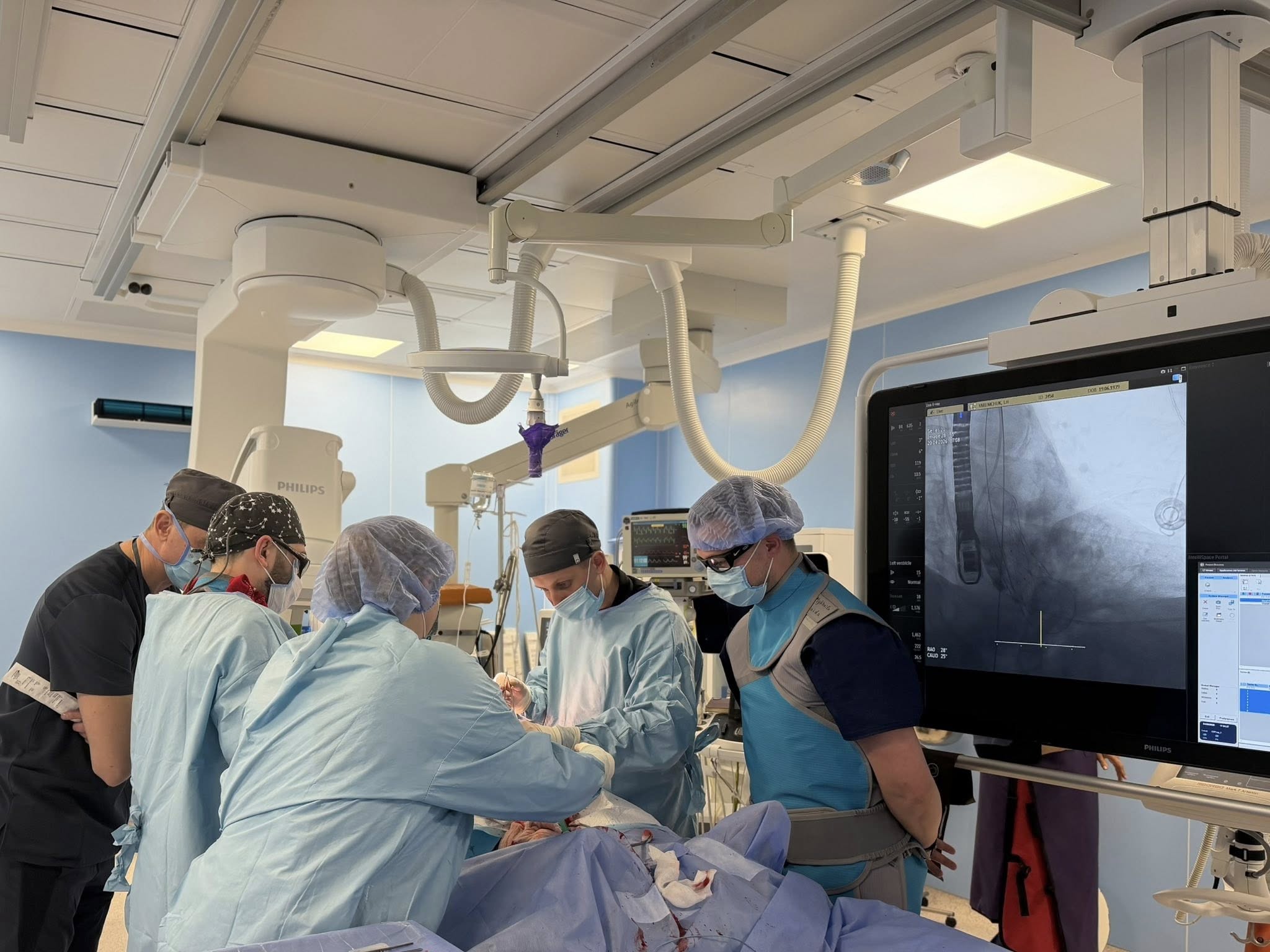 Вінницькі кардіохірурги вперше імплантували клапан у серце через стегнову артерію